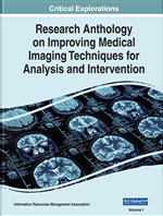 Cover Image for Lesions Detection of Multiple Sclerosis in 3D Brian MR Images by Using Artificial Immune Systems and Support Vector Machines